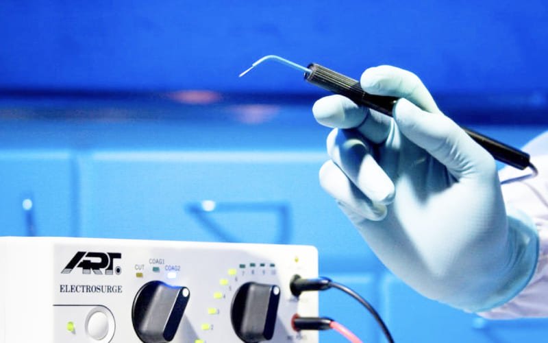 Electrocirugía Cervical en Querétaro