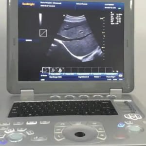 Ultrasonido Genético de 11 a 13.6 semanas